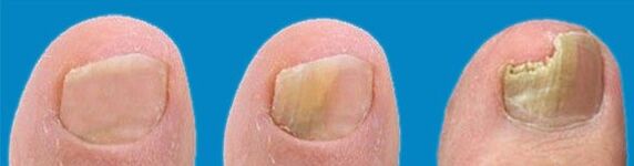 Διαδικασία ανάπτυξης μανιταριών