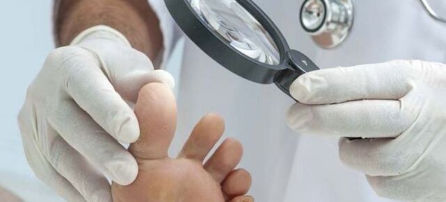 Εξετάσεις πριν από την έναρξη θεραπείας με μύκητες