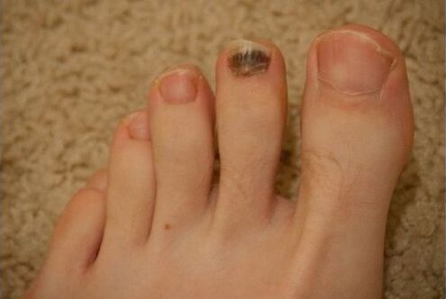 Χρήση από του στόματος και τοπικών φαρμάκων