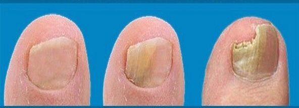 Διαδικασία ανάπτυξης μανιταριών